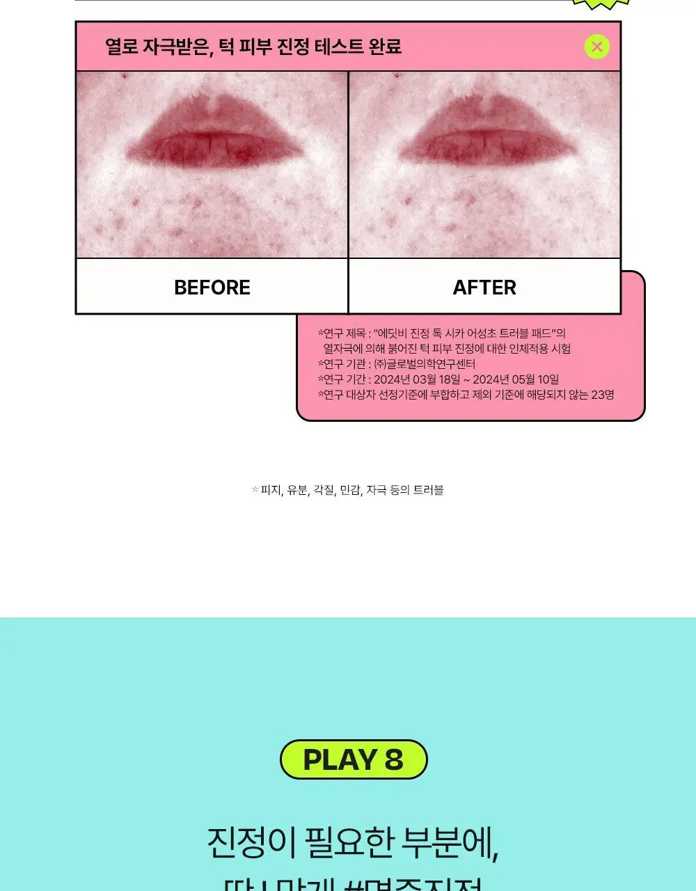 [쿨링진정/찢어쓰는패드] 에딧비 진정 톡 시카 어성초 트러블 패드 70매 상세페이지 30